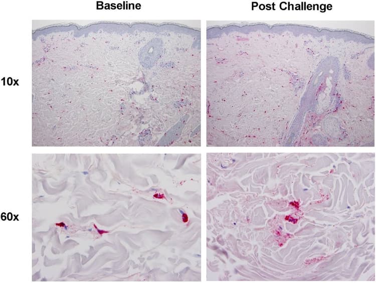 Anti-Mast Cell Tryptase antibody [AA1](ab2378)