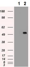 Anti-alpha 1 Antitrypsin antibody [11G2](AB230695)