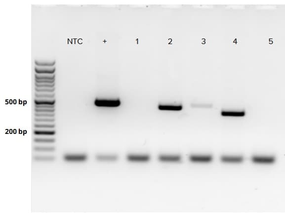 Mycoplasma PCR Detection Kit(AB289834)