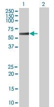 Ab94107  Western Blot Img149900