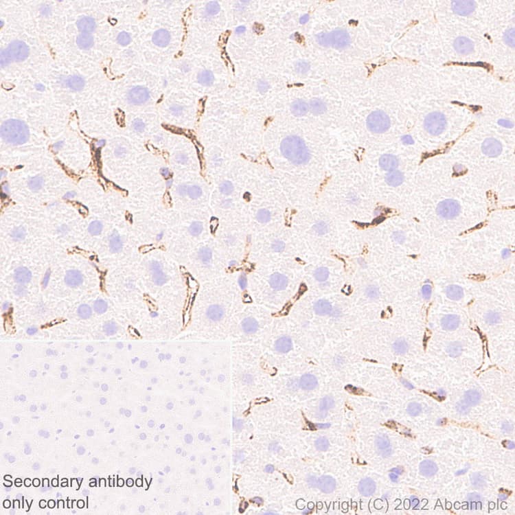 Anti-Mannose Receptor antibody [EPR25215-277](AB300621)
