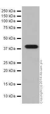Anti-Glutamine Synthetase antibody [EPR16661](AB197024)