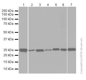 Anti-PGP9.5 antibody [EPR4118] - Neuronal Marker(AB108986)