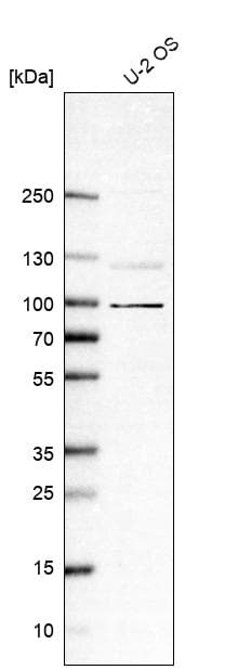 Ddhd1 Antibody Ab151078  Western Blot Img85746