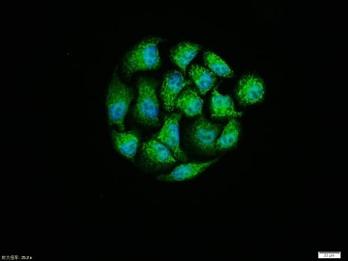 Anti-Melatonin Receptor 1B/MTNR1B antibody(AB203346)