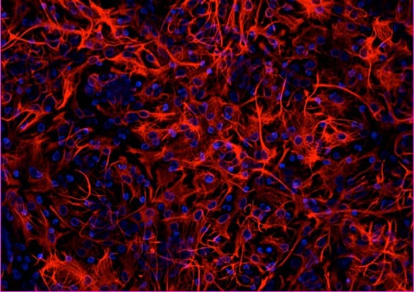 Anti-GFAP antibody(AB134436)