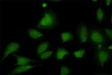 Anti-Stromal interaction molecule 1 antibody [5A2](ab57834)
