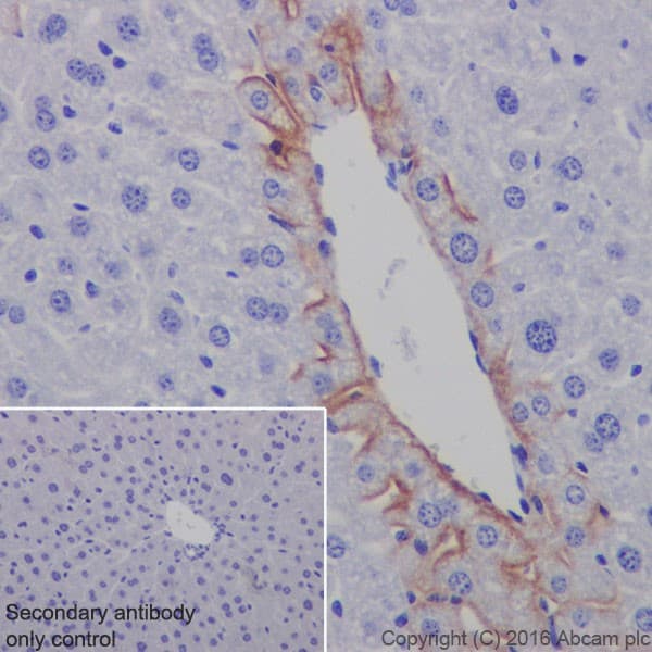 Anti-EAAT2 antibody [EPR19794](AB205247)