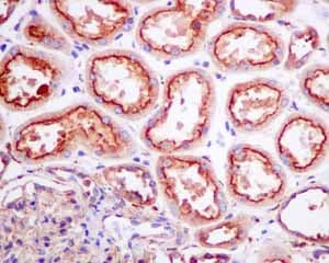 Anti-SCAMP2/SC2 antibody [EPR10185](AB154181)