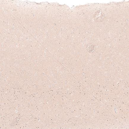 Anti-FOXP2 antibody [CL5312](AB243038)