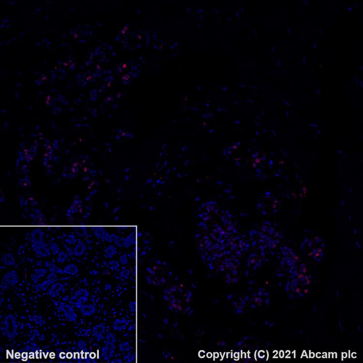 Alexa Fluor® 555 Anti-Estrogen Receptor alpha antibody [SP1](AB282199)