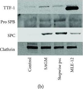 Anti-TTF1/Nkx2-1 antibody [EP1584Y](AB76013)