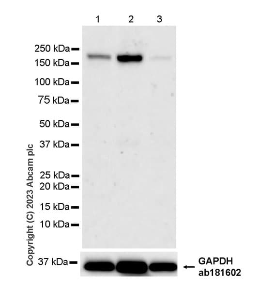 Fyco1 Antibody Epr28361 79 Bsa And Azide Free Ab316013  Western Blot Img426077