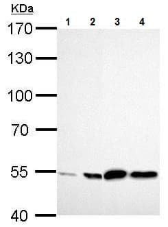Anti-ALDH2 antibody(AB227021)