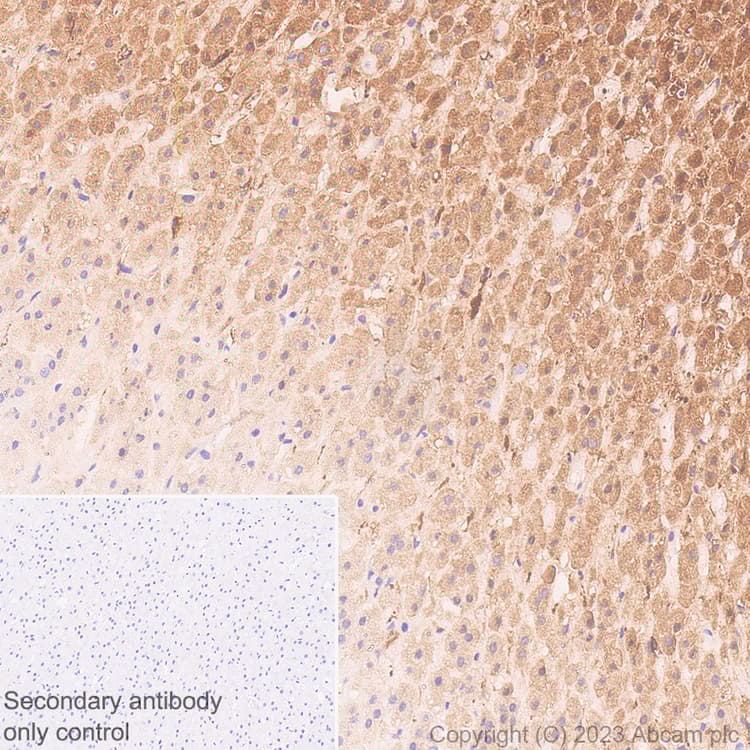 Anti-Tyrosine Hydroxylase antibody [RM1085](AB315252)