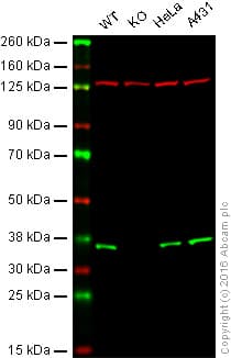 Ppp2cb Antibody Epr11786b Bsa And Azide Free Ab249465  Western Blot Img143945