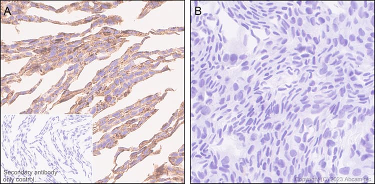 Limpii Antibody Epr26243 125 Ab314217  Immunohistochemistry Formalin Pfa Fixed Paraffin Embedded Sections Img421582