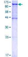 Recombinant Human ALIX protein(AB132534)