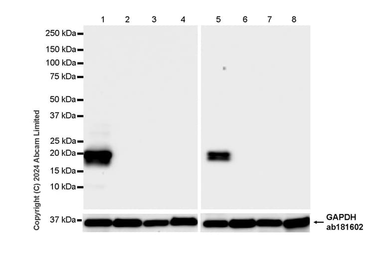 Anti-Prosurfactant Protein C antibody [RM1264](AB322443)