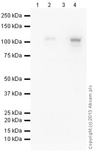Anti-HIF-1 alpha antibody [EP1215Y](ab51608)