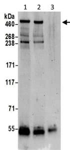 Vps13d Antibody Ab202285  Immunoprecipitation Img22806