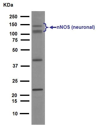 Anti-nNOS (neuronal) antibody [EP1855Y](AB76067)