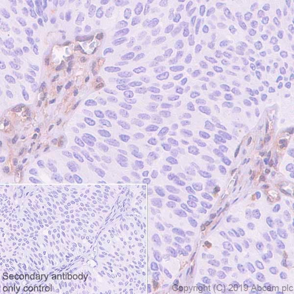 Anti-MTAP antibody [EPR22570-76](ab254265)
