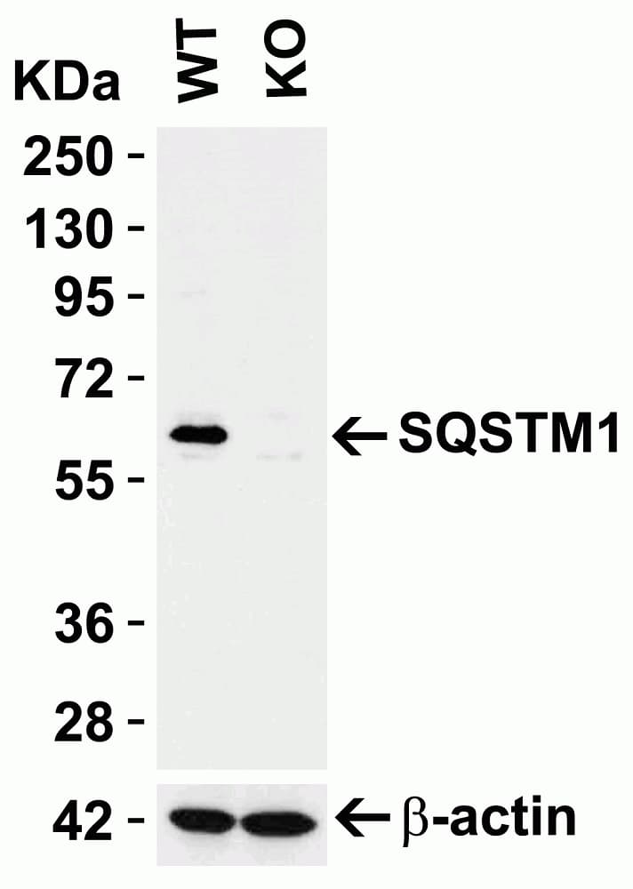 Anti-SQSTM1 / p62 antibody(AB91526)