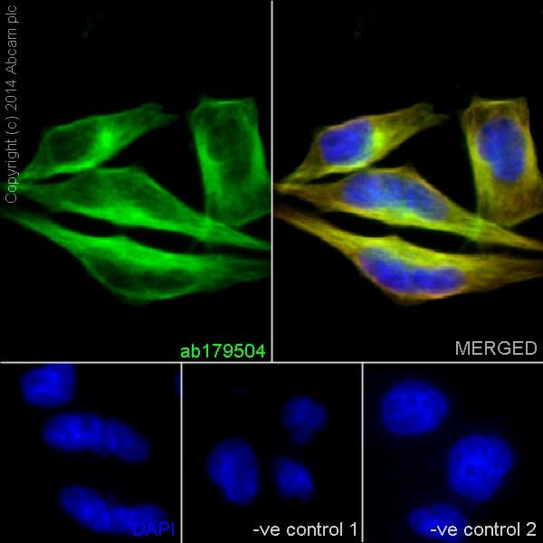 Anti-beta IV Tubulin antibody [EPR16775] - BSA and Azide free(AB250103)