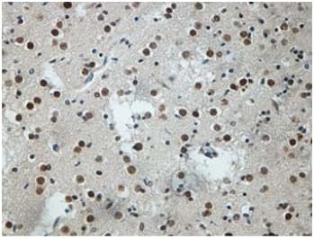 Neuro D4 Antibody C Terminal Ab199299  Immunohistochemistry Formalin Pfa Fixed Paraffin Embedded Sections Img91466