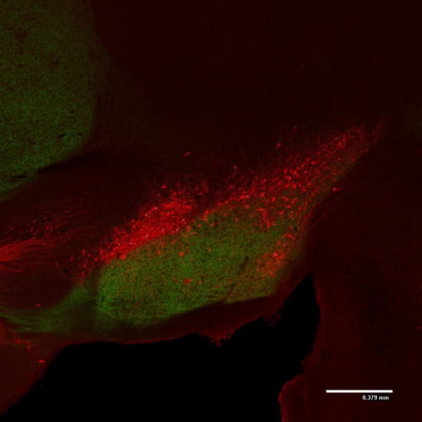 Anti-Tyrosine Hydroxylase antibody(AB76442)