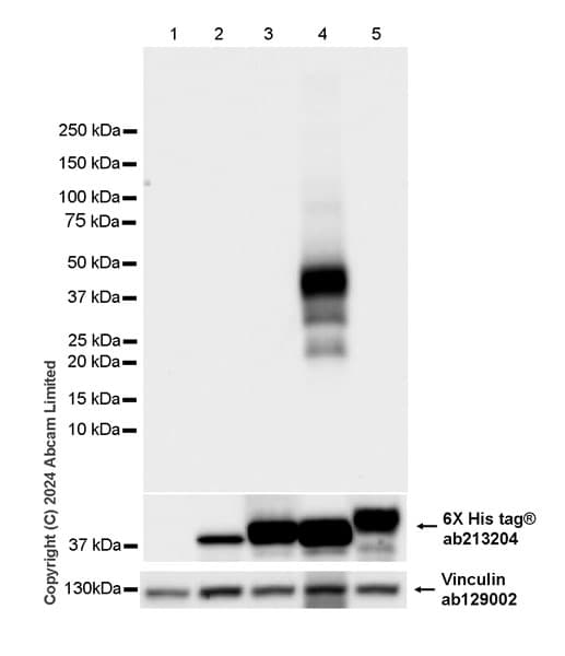 Anti-Cathepsin L/MEP antibody [EPR29413-573](AB321872)