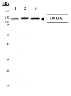 Anti-LDL Receptor antibody(AB30532)