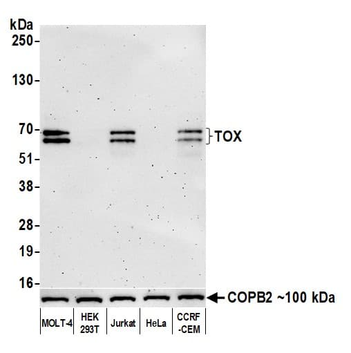 Anti-TOX antibody [BLR212K] - BSA free(AB314043)