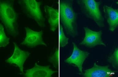 Pkm Antibody Ab137852  Immunocytochemistry Immunofluorescence Img449702
