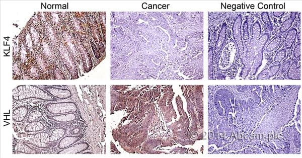 Rabbit specific HRP/Dab Detection IHC Kit(ab64261)