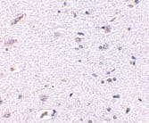 Anti-SNPH antibody(ab69992)