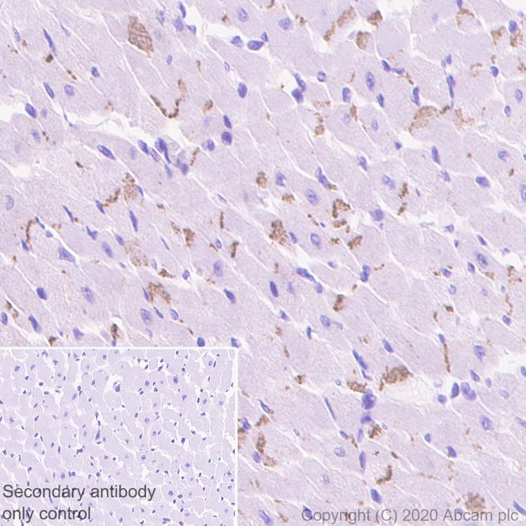 Anti-pan Cadherin antibody [EPR1792Y] - Intercellular Junction Marker(AB51034)