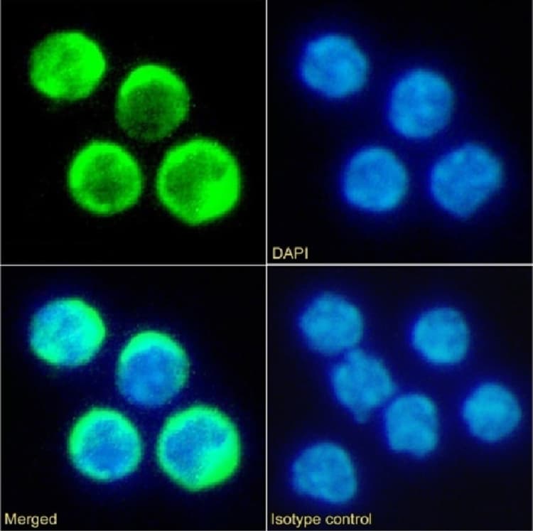 Anti-Tim 2 antibody [RMT2-14] - Rabbit IgG (Chimeric)(AB281910)