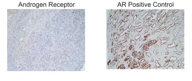 Anti-Androgen Receptor antibody [EPR1535(2)](AB133273)