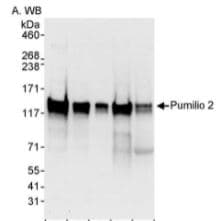 Anti-Pumilio 2 antibody(AB10361)