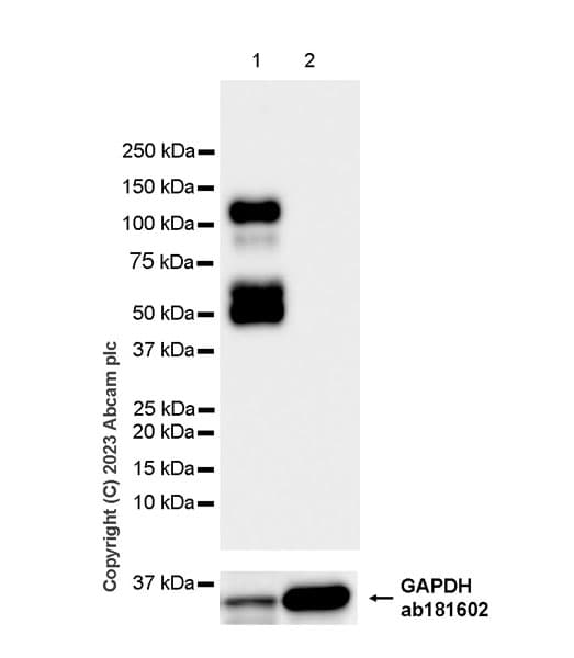 Anti-Aggrecan antibody [EPR28034-86](AB313636)