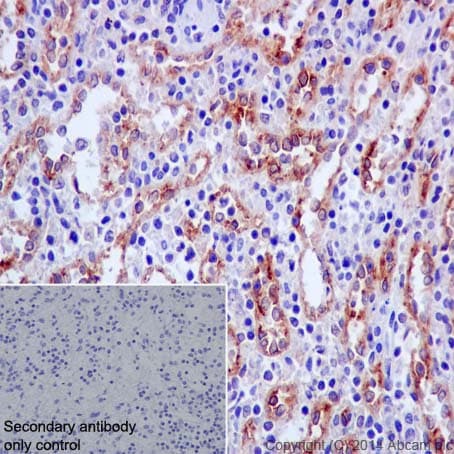 Anti-CD146 antibody [EPR3208](ab75769)
