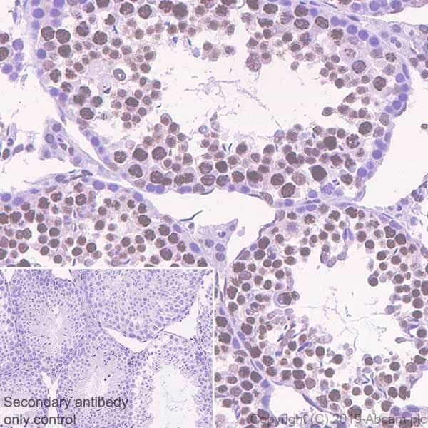 Anti-BRD1/BRL antibody [EPR12960](AB181060)