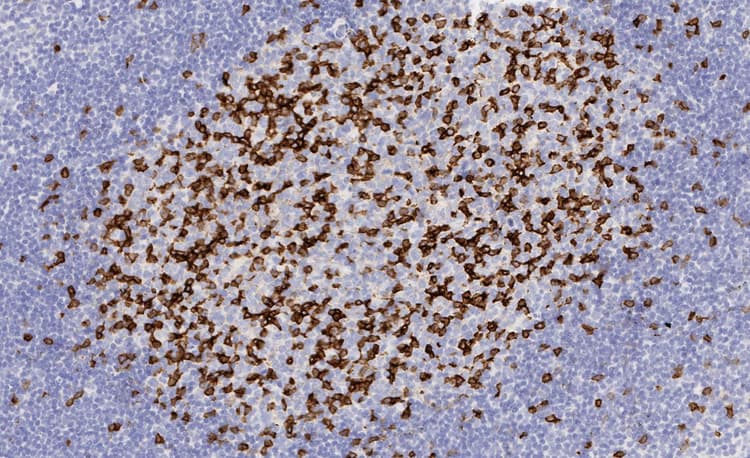 Anti-PD1 antibody [EPR4877(2)] - BSA and Azide free(AB186928)
