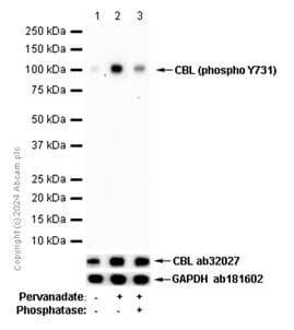 Cbl Phospho Y731 Antibody Ep973y Bsa And Azide Free Ab284695  Western Blot Img435133