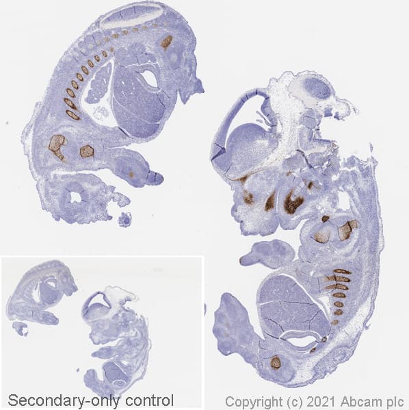 Anti-Sp7 / Osterix antibody [EPR21034](AB209484)
