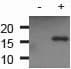 Anti-gamma H2A.X (phospho S139) antibody(AB11174)