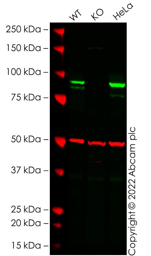 Anti-beta Catenin antibody [E247] - ChIP Grade(AB32572)