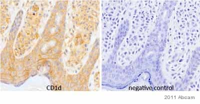 Cd1d Antibody Nor32 Nor32 1317 Ab11076  Immunohistochemistry Formalin Pfa Fixed Paraffin Embedded Sections Img138818